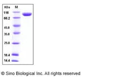 Sino Biological Mouse PIGR Protein (His Tag) 100ug, Quantity: Each of 1