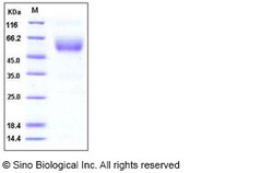 Sino Biological Recombinant Mouse SIGIRR Protein (His & hFc Tag), Quantity: