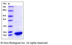 Sino Biological Mouse IL21 / Interleukin 21 Protein 20ug, Quantity: Each