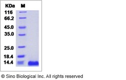 Sino Biological Mouse CXCL16 / SR-PSOX Protein (His Tag) 100ug, Quantity: