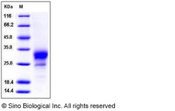 Sino Biological Recombinant Mouse TROY/TNFRSF19 Protein (His Tag), Quantity: