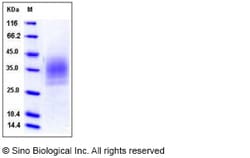 Sino Biological Recombinant Mouse TREM-2 Protein (ECD, His Tag), HPLC-verified,