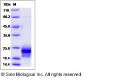 Sino Biological Mouse VEGF-D / VEGFD / FIGF Protein (His Tag) 50ug, Quantity: