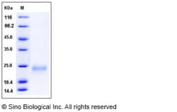 Sino Biological Mouse VEGFA / VEGF164 Protein 1mg, Quantity: Each of 1