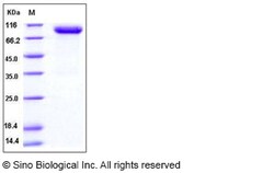 Sino Biological Mouse PLAUR / CD87 / uPAR Protein (His & Fc Tag) 100ug,