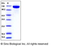 Sino Biological Recombinant Mouse TLR3 Protein (His Tag), Quantity: Each