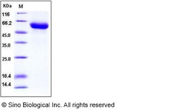 Sino Biological Mouse GFRA1 / GFR alpha-1 Protein (His Tag) 100ug, Quantity: