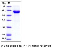 Sino Biological Recombinant Mouse ACVR2B Protein (His & hFc Tag), HPLC-verified,