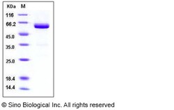 Sino Biological Recombinant Mouse VSIG4 Protein (His & hFc Tag), Quantity: