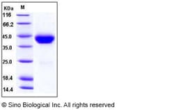 Sino Biological Mouse CD38 Protein (His Tag) 50ug, Quantity: Each of 1