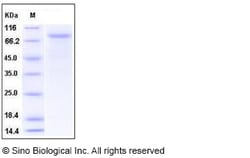 Sino Biological Recombinant Mouse VE-Cadherin Protein (His Tag), Quantity: