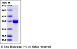 Sino Biological Recombinant Mouse COLEC11 Protein (His Tag), Quantity:
