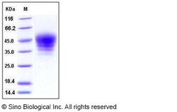 Sino Biological Recombinant Mouse SLAMF7/CRACC/CS1 Protein (His Tag), HPLC-verified,