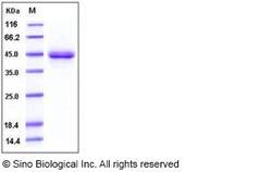 Sino Biological Mouse SFTPD / SP-D / SFTP4 Protein (His Tag) 100ug, Quantity: