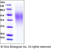 Sino Biological Mouse IL18BP Protein (His Tag) 100ug, Quantity: Each of
