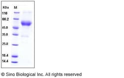 Sino Biological Mouse ALK-1 / ACVRL1 Protein (His & Fc Tag) 200ug, Quantity: