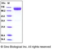 Sino Biological Recombinant Mouse CD200R Protein (His & hFc Tag), Quantity: