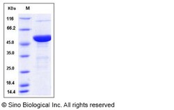 Sino Biological Mouse S100A15 / S100A7A Protein (His & MBP Tag) 50ug, Quantity: