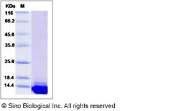 Sino Biological Mouse S100A11 / S100C Protein (His Tag) 100ug, Quantity: