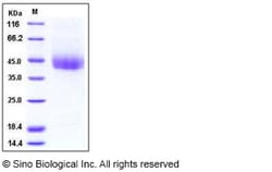 Sino Biological Recombinant Mouse DNAM-1/CD226 Protein (His Tag), HPLC-verified,