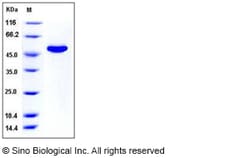 Sino Biological Recombinant Mouse CNDP2 Protein (His Tag), Quantity: Each