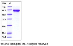 Sino Biological Recombinant Mouse DKK-3 Protein (His Tag), Quantity: Each