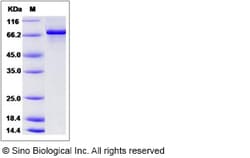 Sino Biological Recombinant Mouse Chk1 Protein (His & GST Tag), Quantity: