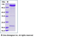 Sino Biological Recombinant Mouse PCSK9 Protein (mFc Tag), Quantity: Each