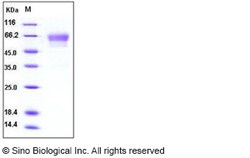Sino Biological Mouse Podoplanin / PDPN Protein (His & Fc Tag) 100ug, Quantity: