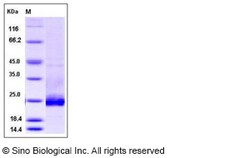 Sino Biological Mouse Podoplanin / PDPN Protein (His Tag) 100ug, Quantity: