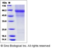 Sino Biological Recombinant Mouse Protein C Protein (His Tag), Quantity: