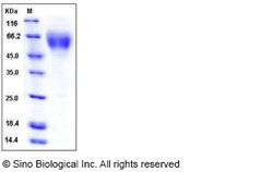Sino Biological Recombinant Mouse DR6/TNFRSF21 Protein (His Tag), Quantity: