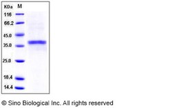 Sino Biological Recombinant Mouse ACP5 Protein (His Tag), Quantity: Each