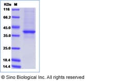 Sino Biological Mouse AGRP Protein (Fc Tag) 200ug, Quantity: Each of 1