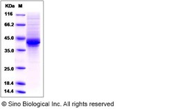 Sino Biological Recombinant Mouse AGRP Protein (hFc Tag), Quantity: Each