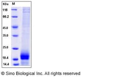 Sino Biological Mouse AGRP / AgRP Protein (His Tag) 200ug, Quantity: Each
