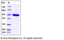 Sino Biological Mouse PPM1A / PP2CA / PP2C-alpha Protein (His Tag) 100ug,