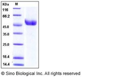 Sino Biological Recombinant Mouse Renin Protein (His Tag), Quantity: Each