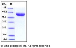 Sino Biological Mouse IL6RA / CD126 Protein (His Tag) 50ug, Quantity: Each