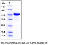 Sino Biological Recombinant Mouse LRPAP1 Protein (His Tag), HPLC-verified,