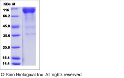 Sino Biological Recombinant Mouse CLEC4F Protein (ECD, hFc Tag), Quantity: