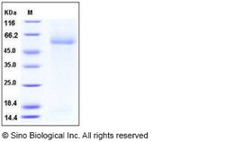 Sino Biological Recombinant Mouse MARCO Protein (His Tag), Quantity: Each