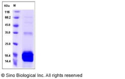 Sino Biological Recombinant Mouse S100A9 Protein (His Tag), HPLC-verified,