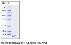 Sino Biological Mouse Uteroglobin / SCGB1A1 Protein (His Tag) 100ug, Quantity: