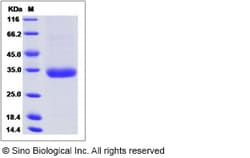 Sino Biological Recombinant Mouse Angiopoietin-2/ANGPT2 Protein (His Tag),