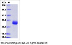 Sino Biological Mouse Angiopoietin 1 / ANG1 / ANGPT1 Protein (His Tag)