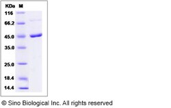 Sino Biological Recombinant Mouse MEK1 Protein, Quantity: Each of 1