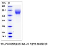 Sino Biological Mouse SerpinA6 / CBG Protein (His Tag) 100ug, Quantity: