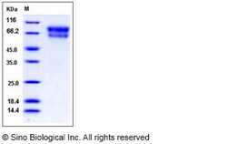 Sino Biological Mouse SerpinA10 / ZPI Protein (His Tag) 100ug, Quantity: