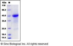 Sino Biological Mouse R-Spondin 1 / RSPO1 Protein (His Tag) 100ug, Quantity: